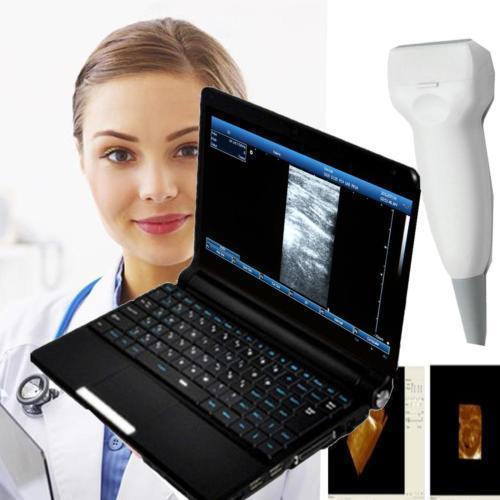 Laptop Ultrasound machine Scanner system 7.5Mhz High Frequecy Linear Probe+3D A+ DIAGNOSTIC ULTRASOUND MACHINES FOR SALE