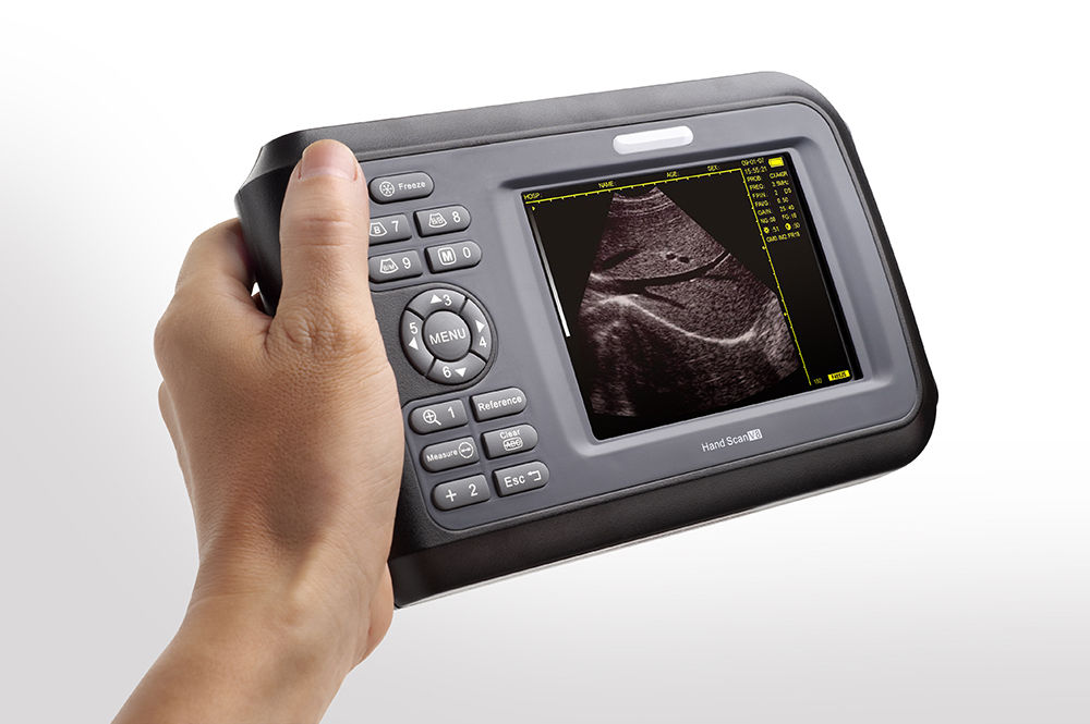 Portable 5.5 Inch Digital LCD Check Ultrasound Scanner & 7.5Mhz linear Probe CE 190891410818 DIAGNOSTIC ULTRASOUND MACHINES FOR SALE