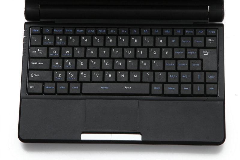 Digital Laptop Ultrasound Scanner Convex + Linear Probe 3D Ultrasound Pregnant DIAGNOSTIC ULTRASOUND MACHINES FOR SALE