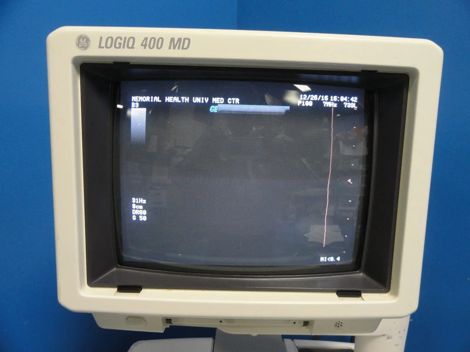 GE Logiq 400 MD Soft Pack Ultrasound W/ C364, C551, 739L Probes & Printer~12413 DIAGNOSTIC ULTRASOUND MACHINES FOR SALE