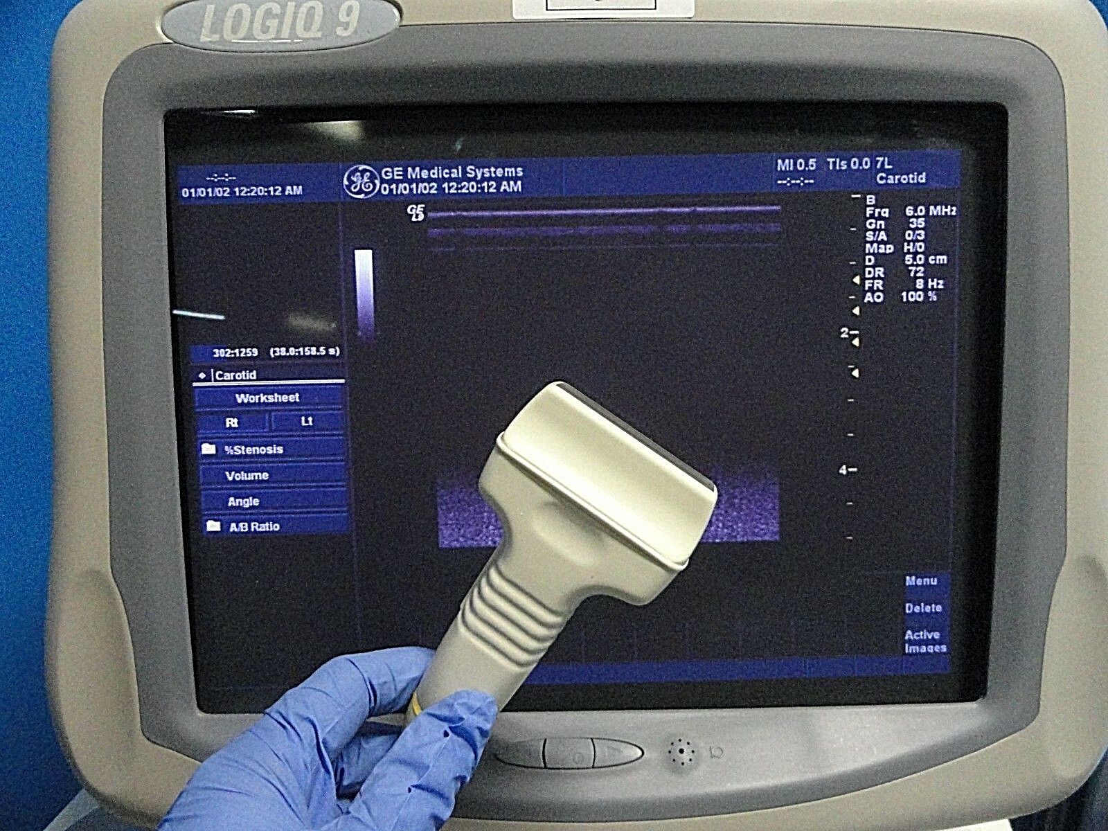 2011 GE 7L P/N 2302648 Linear Ultrasound Probe For Logiq & Vivid Series~16678 DIAGNOSTIC ULTRASOUND MACHINES FOR SALE