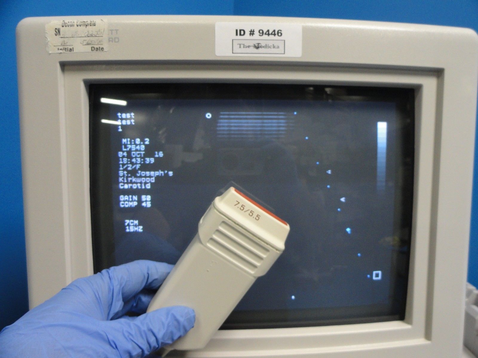 a hand in a blue glove holding a PROBE in front of a monitor