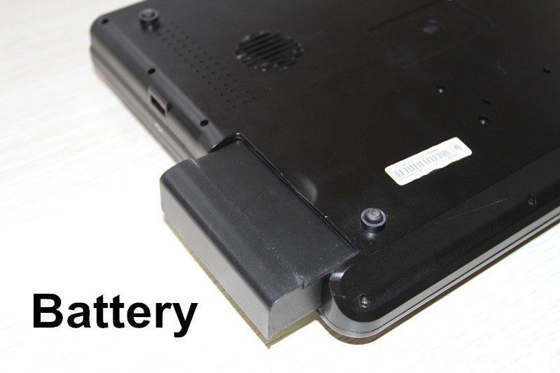 Digital Portable Laptop Ultrasound Scanner Machine 7.5M Linear Probe 600P2 CE 658126923446 DIAGNOSTIC ULTRASOUND MACHINES FOR SALE