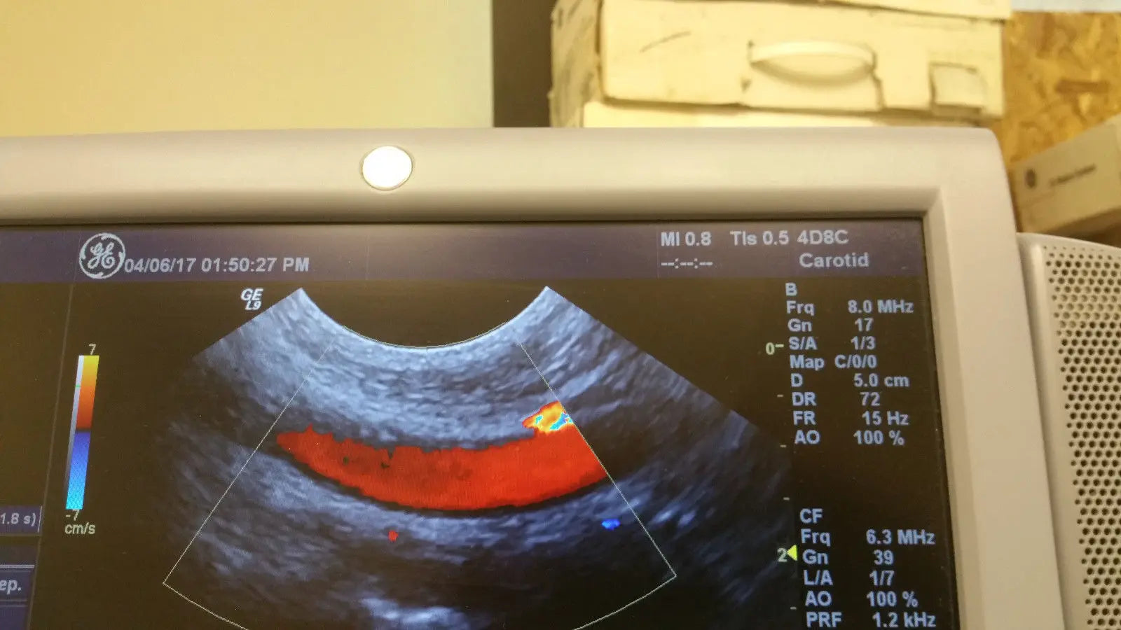 GE 4D8C Convex 4D Ultrasound Transducer Probe DIAGNOSTIC ULTRASOUND MACHINES FOR SALE