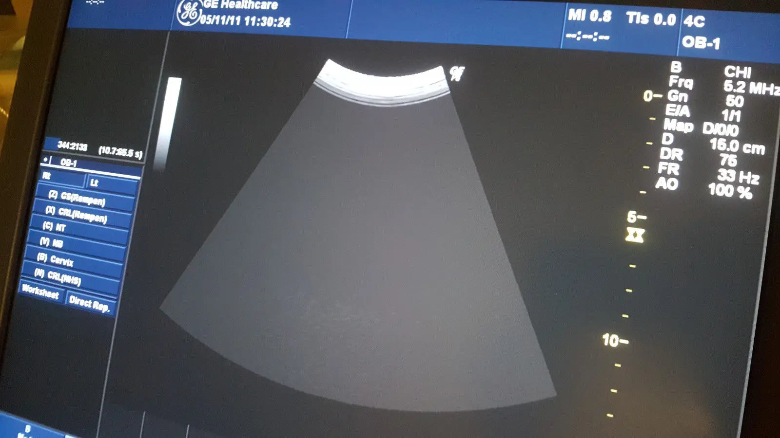 GE Logiq P6 Diagnostic Ultrasound unit OB/GYN/Abd DIAGNOSTIC ULTRASOUND MACHINES FOR SALE