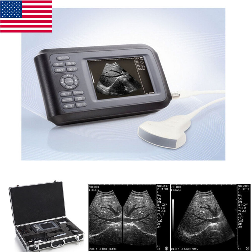 Handheld Ultrasound Scanner/Machine Convex Probe Abdominal Ultrasound Human Sale 190891466976 DIAGNOSTIC ULTRASOUND MACHINES FOR SALE