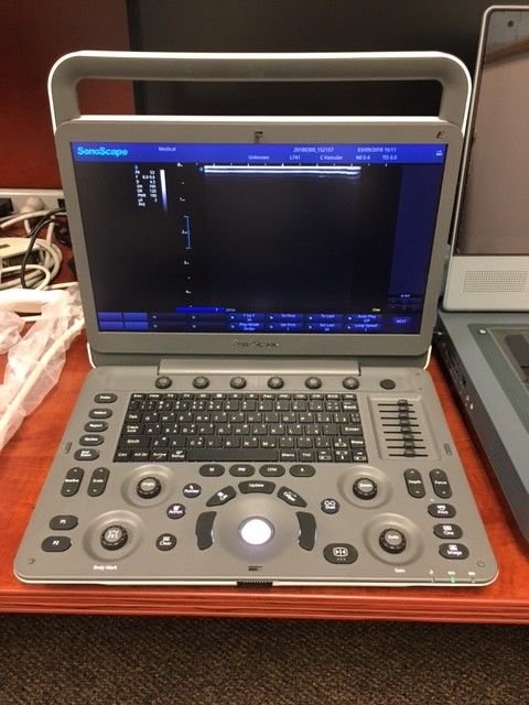 NEW Sonoscape E1 Portable Ultrasound System DIAGNOSTIC ULTRASOUND MACHINES FOR SALE