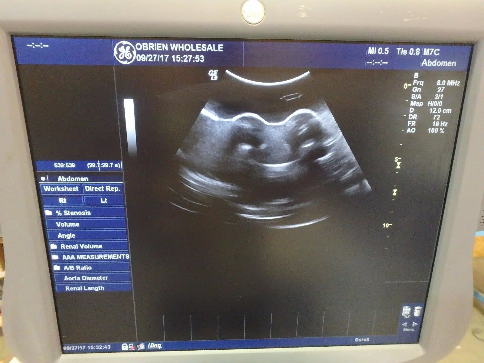 GE M7C Convex Array Ultrasound Transducer Probe Medical DIAGNOSTIC ULTRASOUND MACHINES FOR SALE