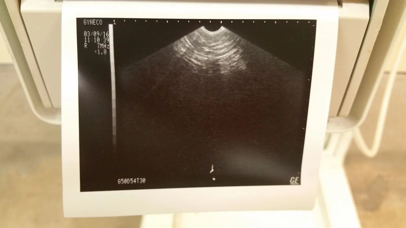 GE RT 3200 Advantage-I Ultrasound Inv 3430 DIAGNOSTIC ULTRASOUND MACHINES FOR SALE