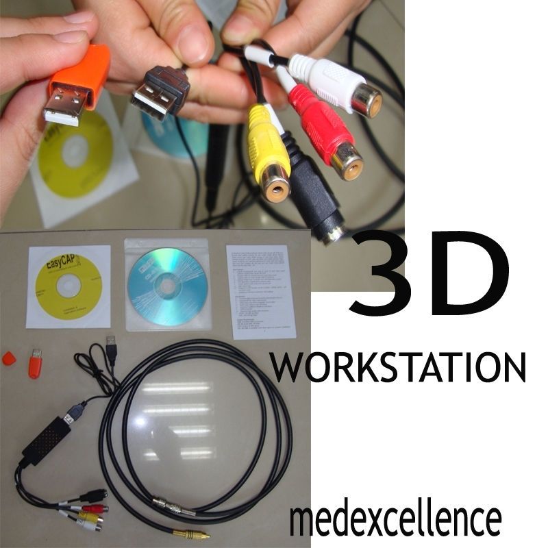 Digital Ultrasound Scanner +3 Probes Transvaginal Linear Mirco Convex w free 3D DIAGNOSTIC ULTRASOUND MACHINES FOR SALE