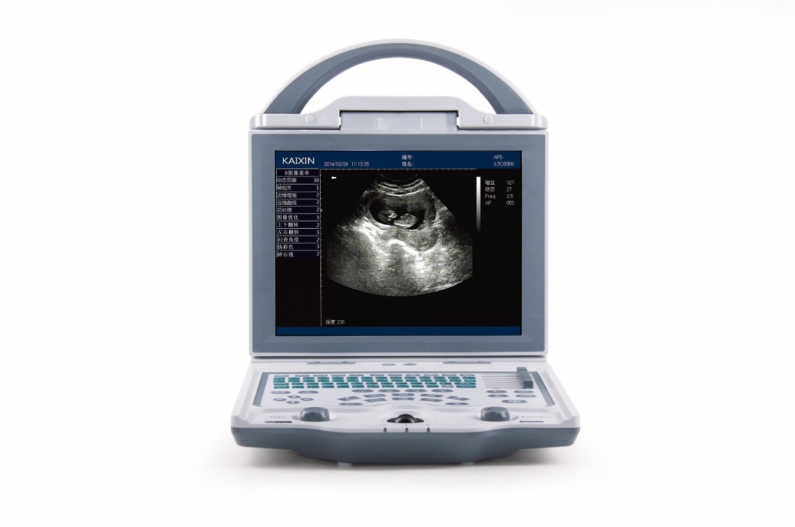 KX5600V Veterinary Ultrasound Machine Laptop, LED, DICOM, Battery | KeeboMed DIAGNOSTIC ULTRASOUND MACHINES FOR SALE