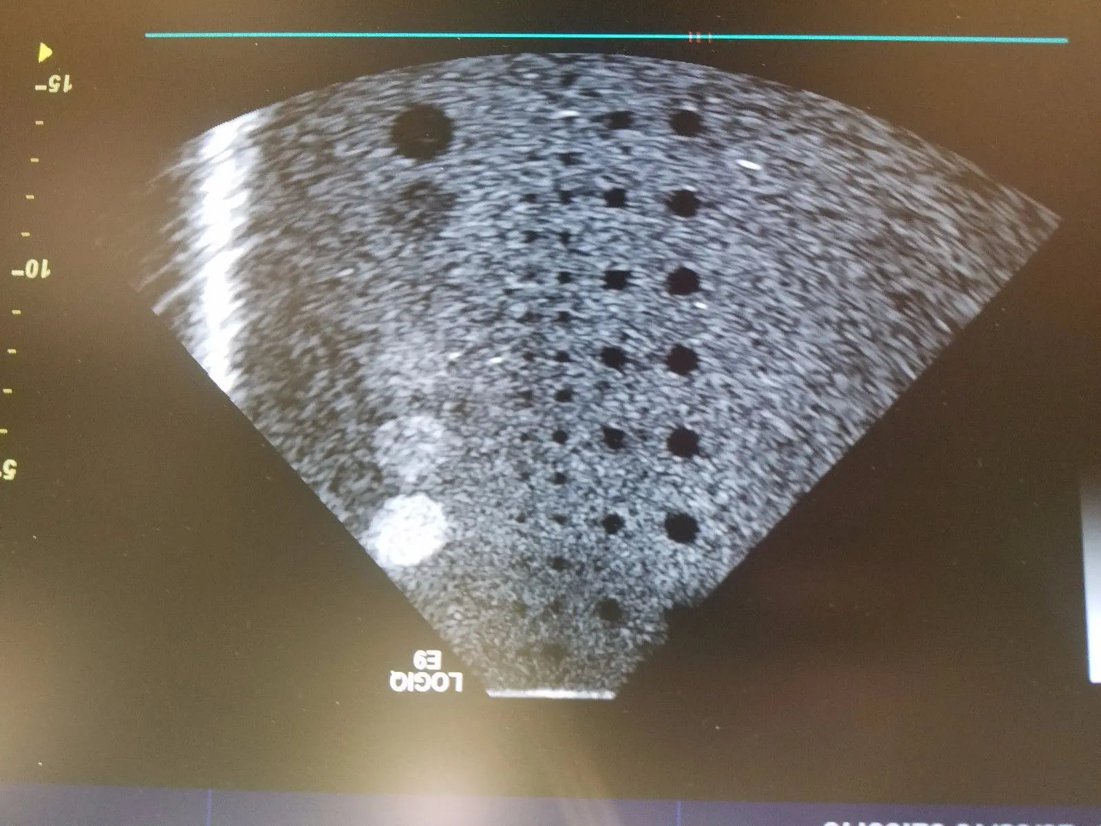 GE S1-5 Ultrasound Transducer Probe DIAGNOSTIC ULTRASOUND MACHINES FOR SALE