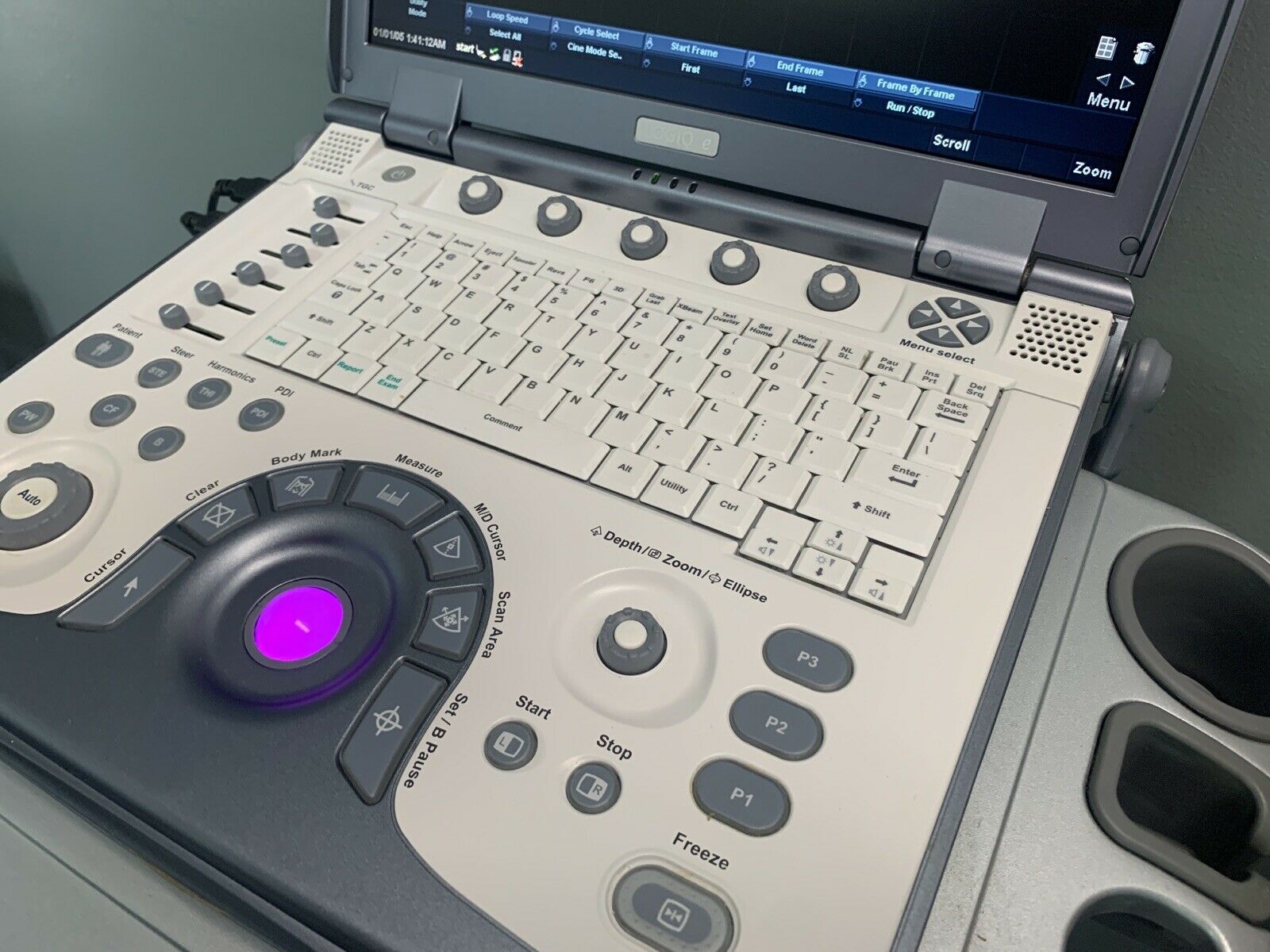 GE Logiq E Ultrasound 2007 DIAGNOSTIC ULTRASOUND MACHINES FOR SALE