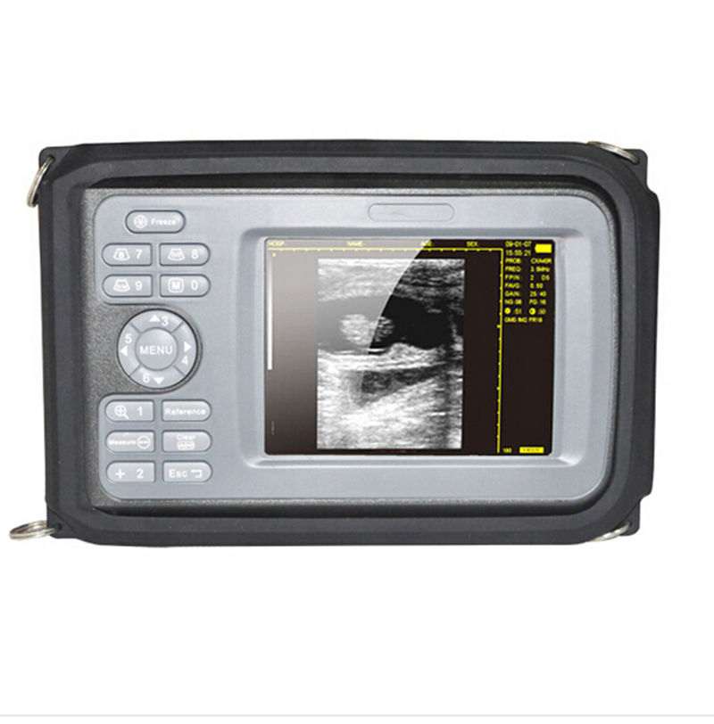 Handheld Ultrasound Machine Scanner Digital Micro-convex Probe+ Box Human Use DIAGNOSTIC ULTRASOUND MACHINES FOR SALE
