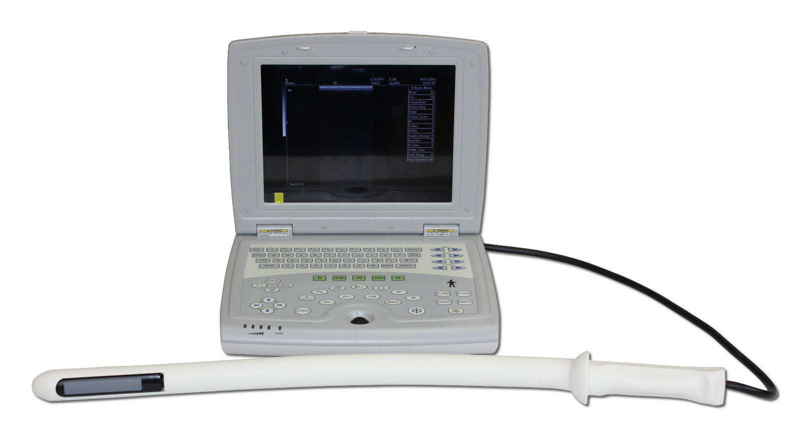 KX5000V Veterinary Laptop Ultrasound-Bovine/Horse&Rectal Insertion Arm-Keebomed DIAGNOSTIC ULTRASOUND MACHINES FOR SALE