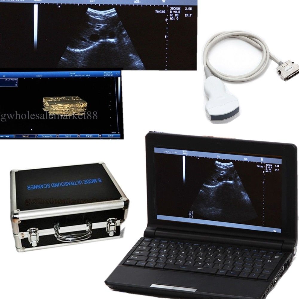 LED 3D Full Digital Laptop Ultrasound Scanner/Machine 3.5M Convex Probe Hospital 190891302670 DIAGNOSTIC ULTRASOUND MACHINES FOR SALE