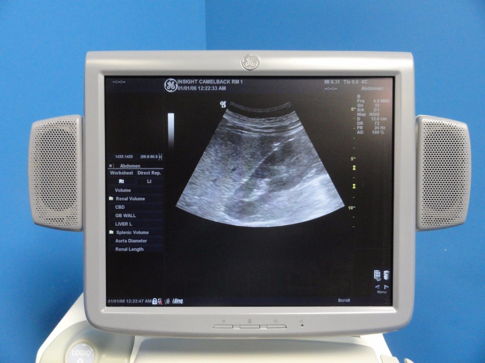 GE Logiq 9 LCD Ultrasound System W/ M12L, 7L, 4C, 4D3C-L Probes & Printer 10369 DIAGNOSTIC ULTRASOUND MACHINES FOR SALE