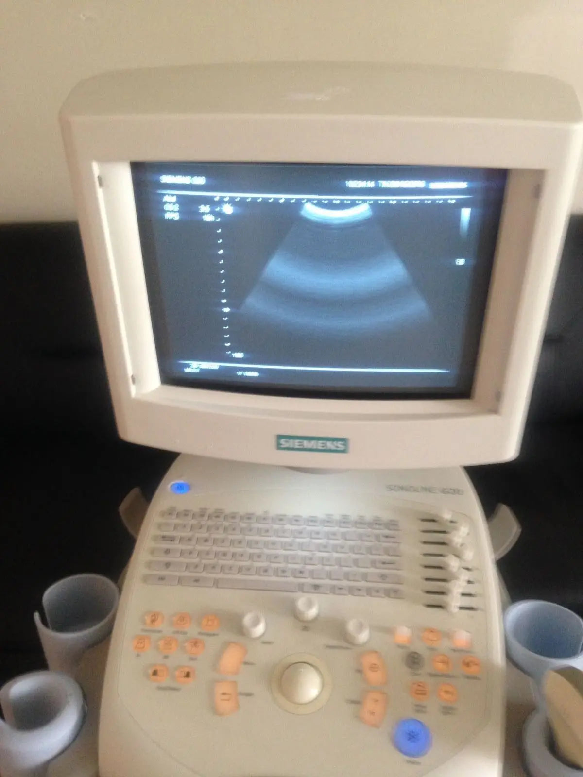 Siemens Sonoline  G20 Diagnostic Ultrasound System DIAGNOSTIC ULTRASOUND MACHINES FOR SALE