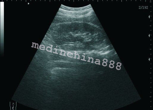 Portable LCD Digital 10.1-Inch Ultrasound Scanner + Convex+Transvaginal Probe CE DIAGNOSTIC ULTRASOUND MACHINES FOR SALE