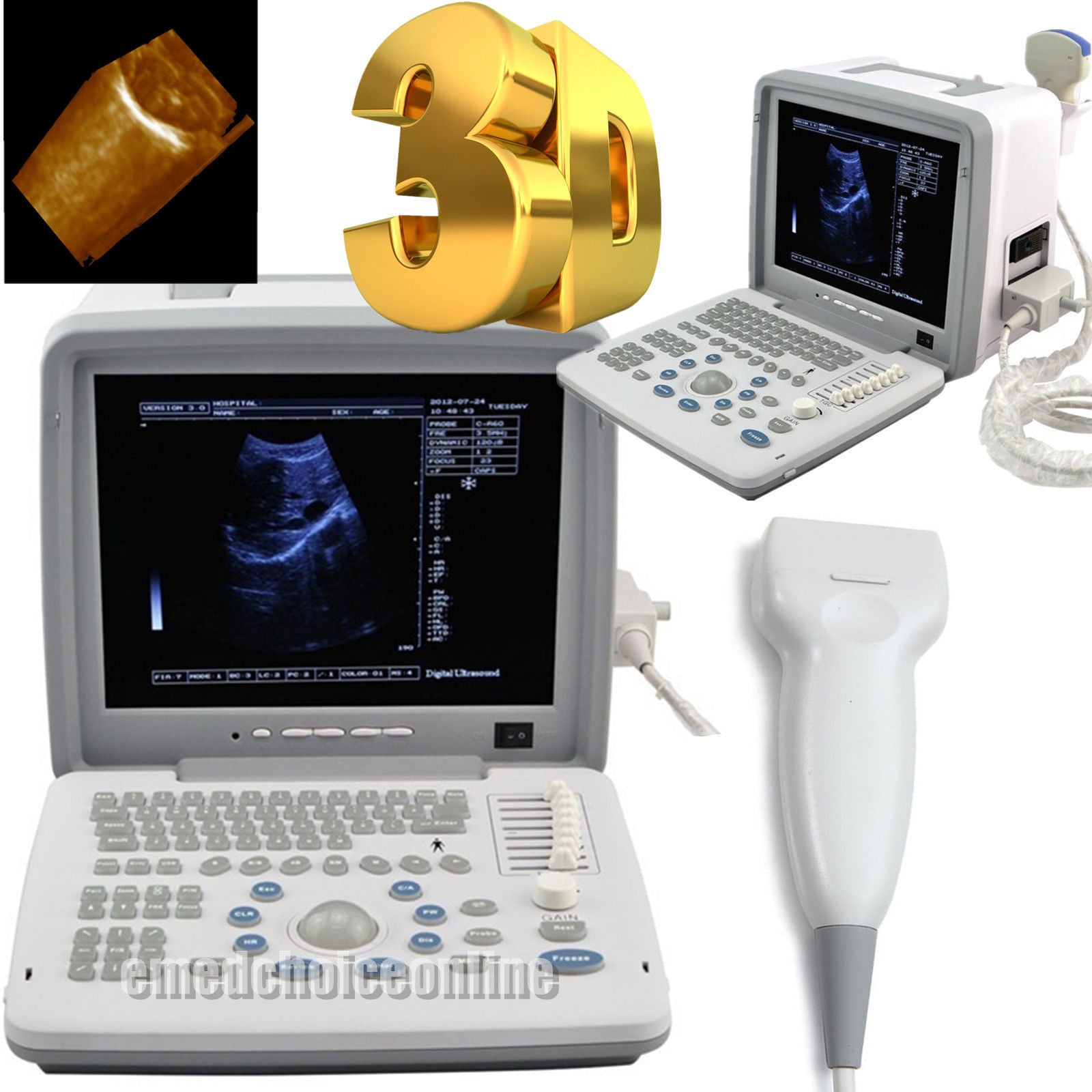 Top selling Medical Ultrasound Scanner System + linear Probe + 3D system DIAGNOSTIC ULTRASOUND MACHINES FOR SALE