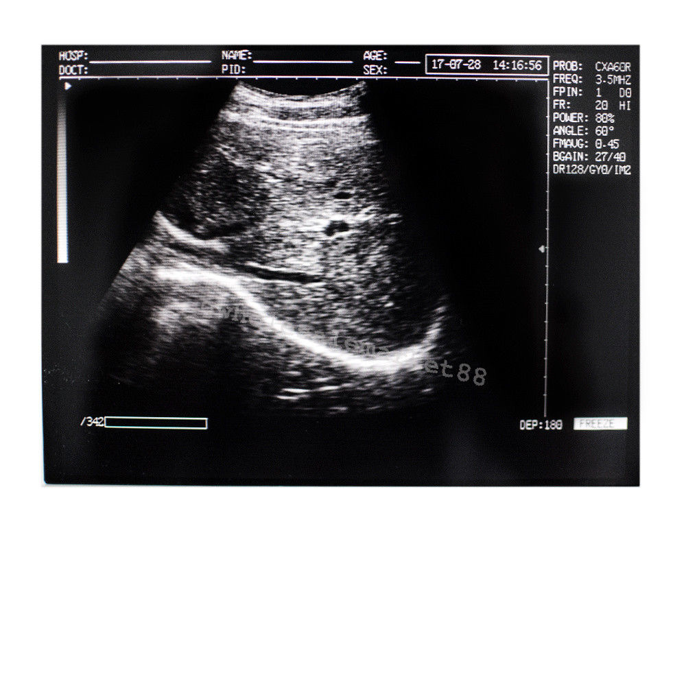 Portable Ultrasound Machine Scanner System Convex probe 3D Software Best Image 190891045898 DIAGNOSTIC ULTRASOUND MACHINES FOR SALE