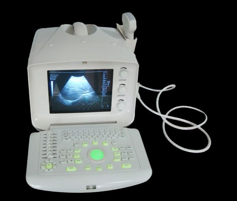 Digital Ultrasound Scanner Machine+Convex +Micro-convex 2 Probes + Oximeter Sale DIAGNOSTIC ULTRASOUND MACHINES FOR SALE