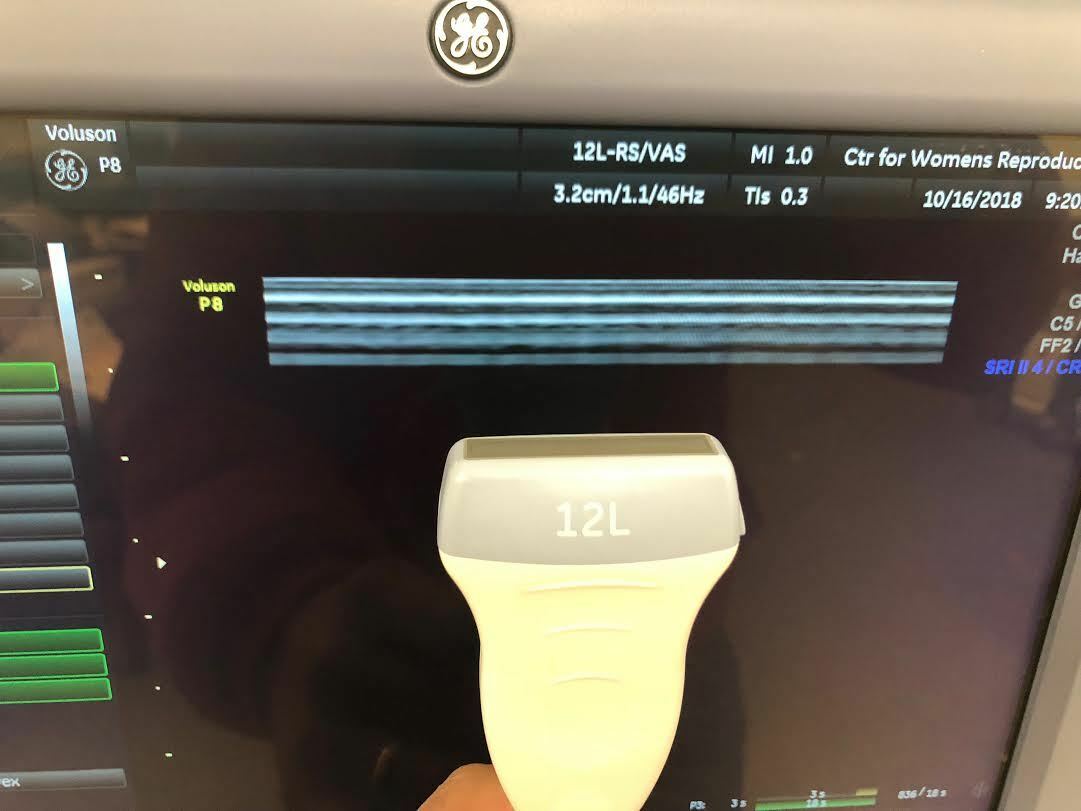 GE Voluson P8 Ultrasound Machine with E8C-RS, 12-RS, 4C-RS Probes DIAGNOSTIC ULTRASOUND MACHINES FOR SALE