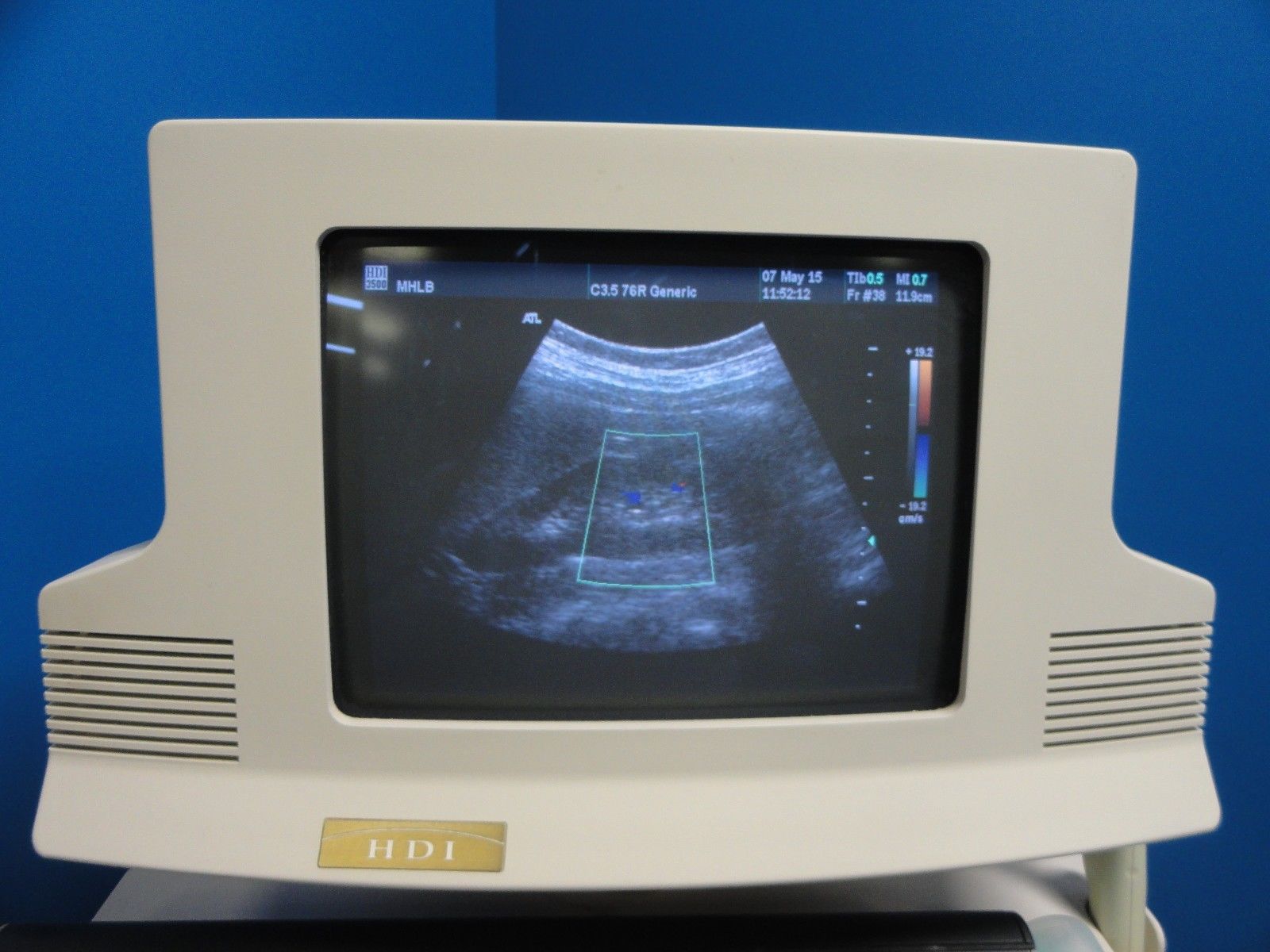 ATL C3.5 76R Convex / Curved Array Ultrasound Transducer Probe (8841) DIAGNOSTIC ULTRASOUND MACHINES FOR SALE