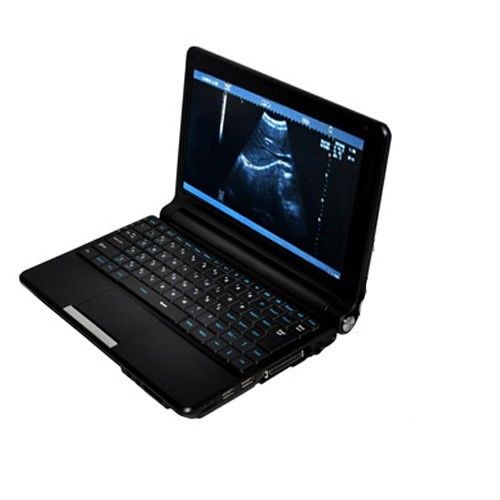 Digital Laptop Machine Ultrasound Scanner +Convex& Vignal &Linear 3 Probe &3D DIAGNOSTIC ULTRASOUND MACHINES FOR SALE