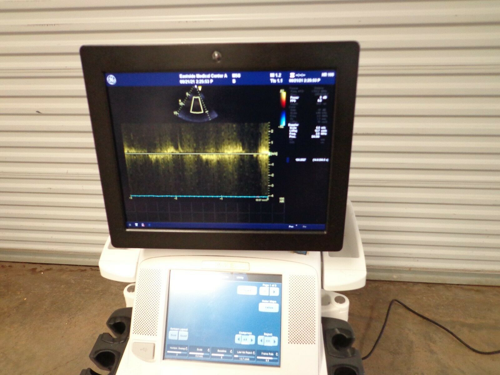 GE VIVID E9 Ultrasound System M5S Probe Color Roll DIAGNOSTIC ULTRASOUND MACHINES FOR SALE