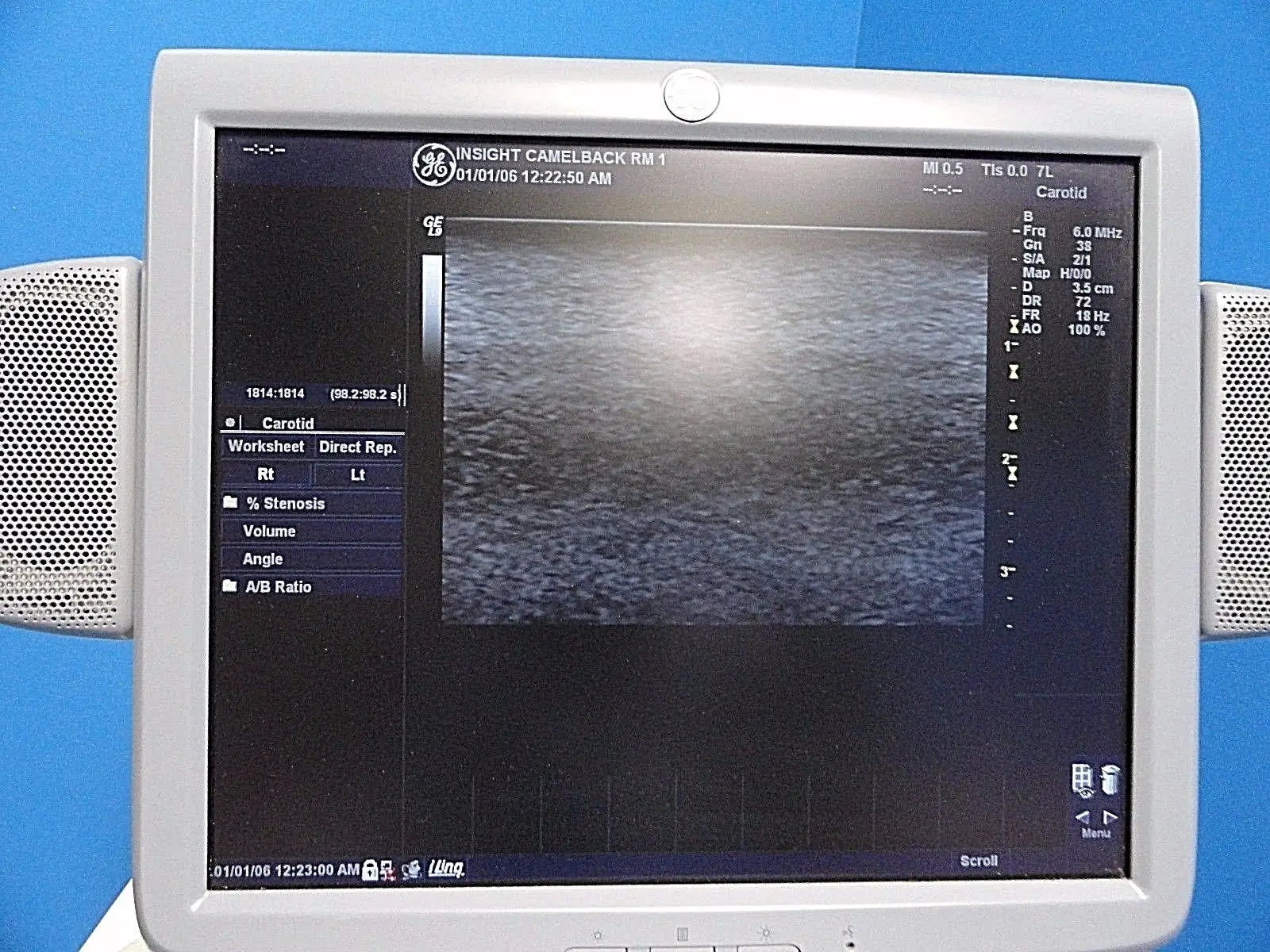 GE 7L / 2302648 Linear Array Ultrasound Probe for Logiq & Vivid Series~13787 DIAGNOSTIC ULTRASOUND MACHINES FOR SALE