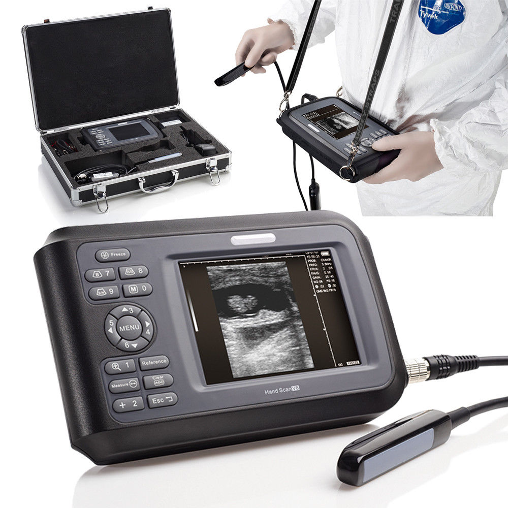 Medical Pro Handheld Digital Ultrasound Scanner Machine Cardiac+Rectal Probe DIAGNOSTIC ULTRASOUND MACHINES FOR SALE