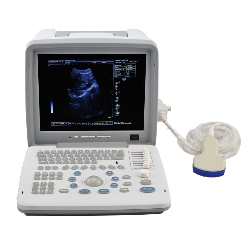 Medical 3D Digital Portable Ultrasound Scanner 3.5M Convex + 7.5M Linear 2 Probe DIAGNOSTIC ULTRASOUND MACHINES FOR SALE