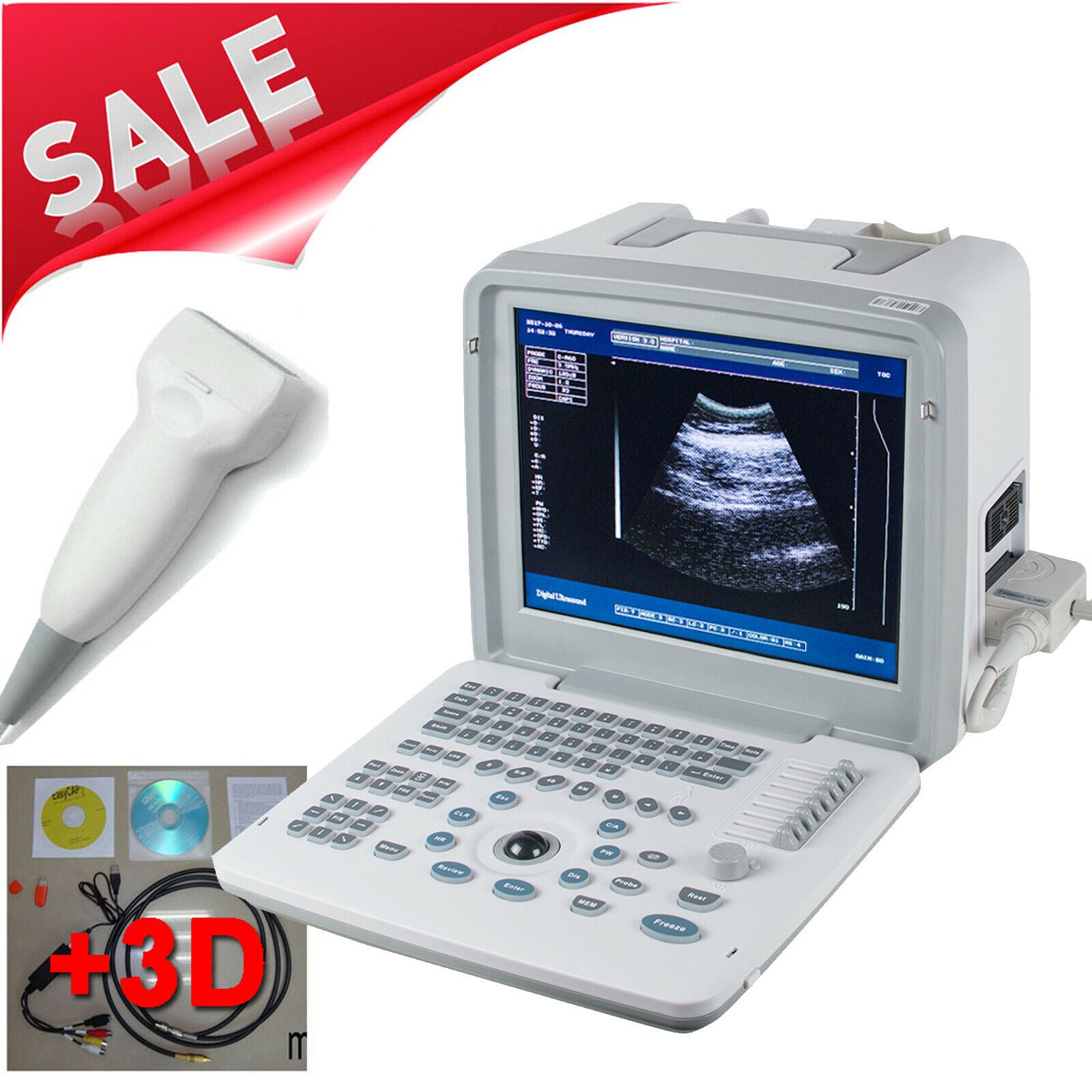 High Resolution Full Digital LCD Portable Ultrasound Scanner Machine Linear 3D DIAGNOSTIC ULTRASOUND MACHINES FOR SALE