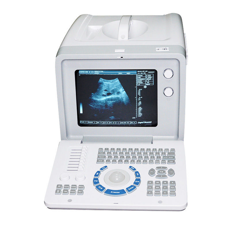 Profession Digital Ultrasound Scanner Convex Probe 3D software Optional Linear 190891927064 DIAGNOSTIC ULTRASOUND MACHINES FOR SALE