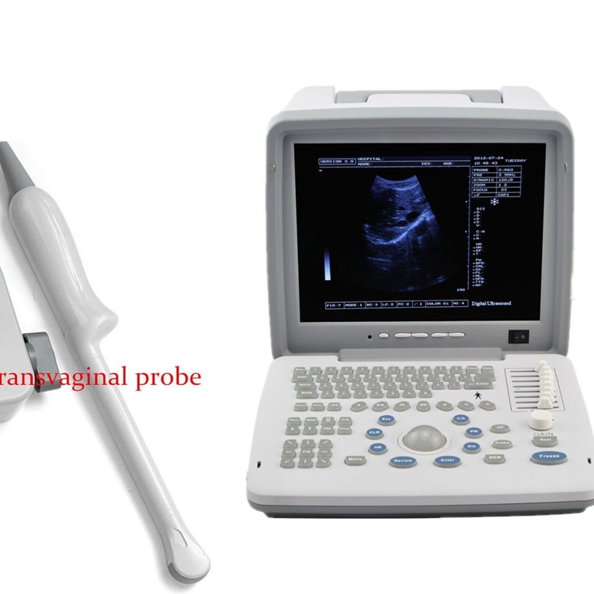 Full Digital Laptop Portable Ultrasound Scanner+Transvaginal Probe external 3D DIAGNOSTIC ULTRASOUND MACHINES FOR SALE
