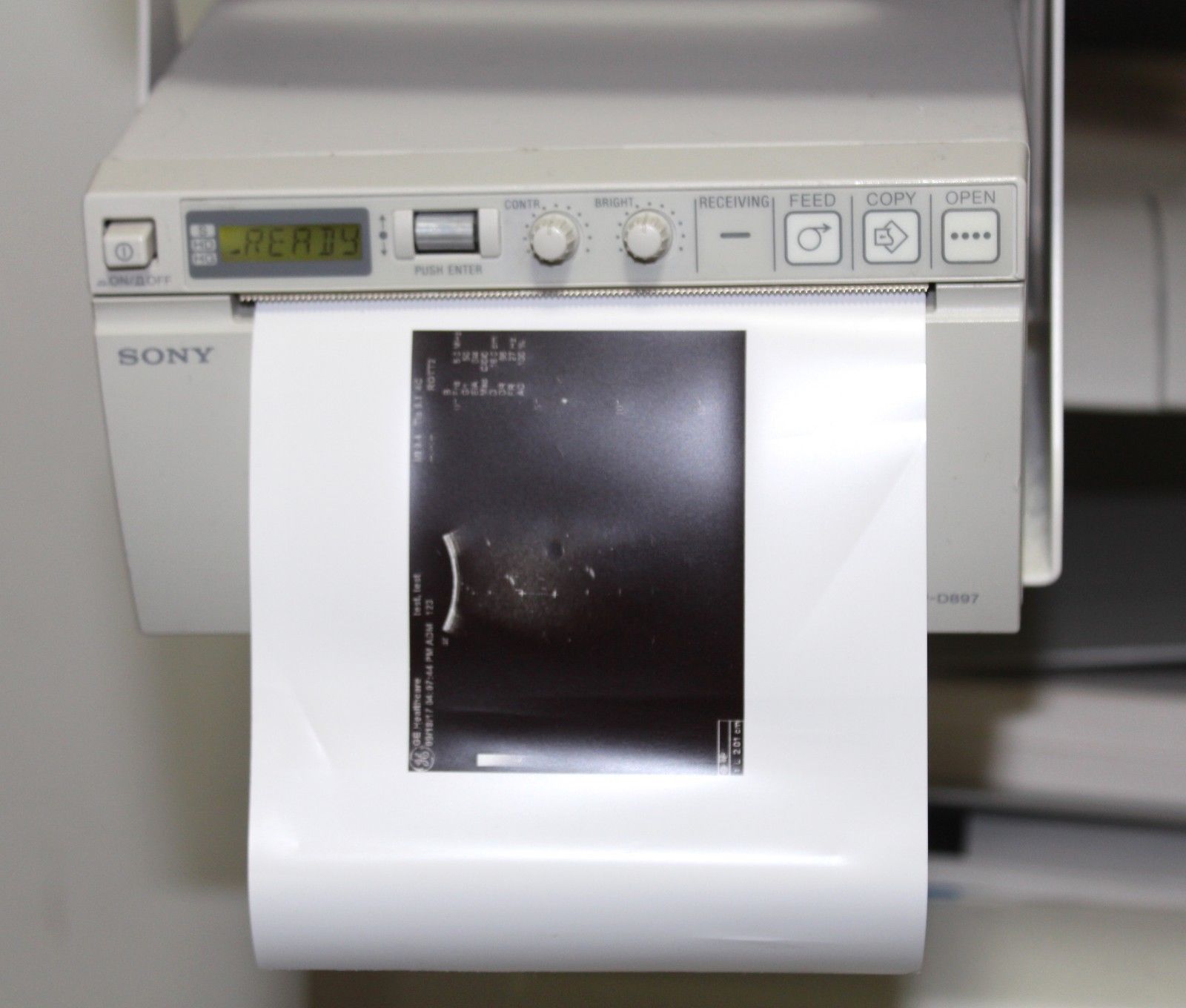 GE Logiq P5 Ultrasound System with 2 Probes DIAGNOSTIC ULTRASOUND MACHINES FOR SALE