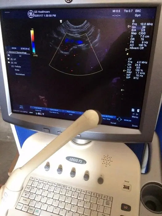 GE Logiq P3 Expert Ultrasound System R1.0.5 DIAGNOSTIC ULTRASOUND MACHINES FOR SALE
