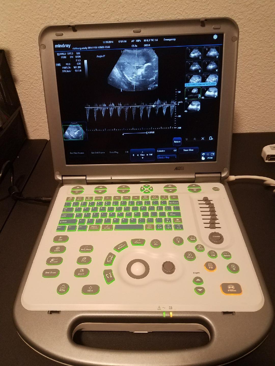 Mindray M5 Portable Ultrasound Machine with 3 Probes, barely used DIAGNOSTIC ULTRASOUND MACHINES FOR SALE