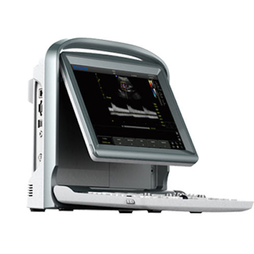 Color Doppler Ultrasound Scanner with Two Probes, Battery - Chison ECO5-Vascular DIAGNOSTIC ULTRASOUND MACHINES FOR SALE