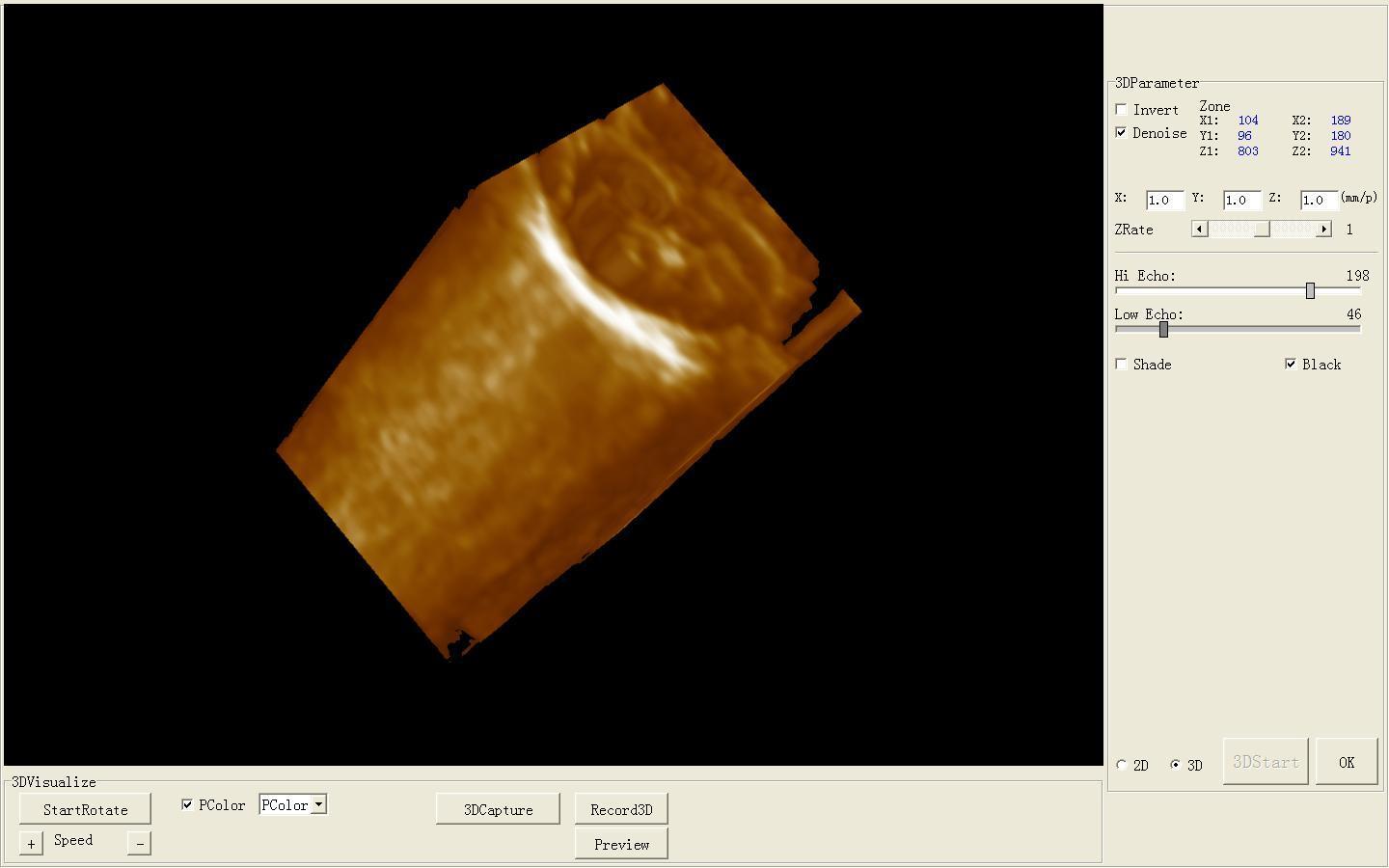 Top selling Medical Ultrasound Scanner System + linear Probe + 3D system DIAGNOSTIC ULTRASOUND MACHINES FOR SALE
