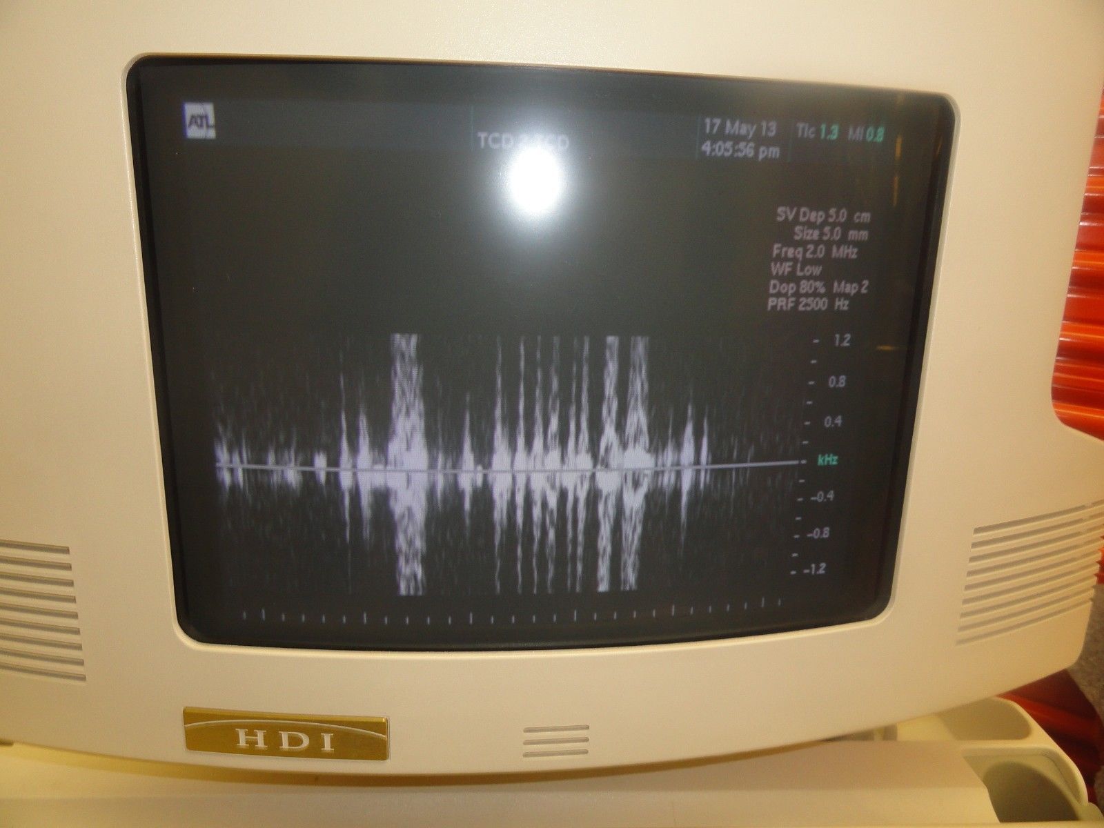 ATL D2TC Static HDI 2.0MHz P/N 4000-0310-02 PW Doppler Transcranial Probe ~5554 DIAGNOSTIC ULTRASOUND MACHINES FOR SALE