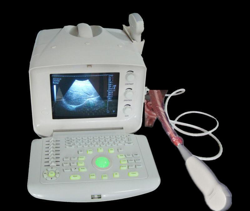 Medical Ultrasound Scanner/Machine 5.0 Micro-convex Array Probe Factory SEll CE* 190891843524 DIAGNOSTIC ULTRASOUND MACHINES FOR SALE