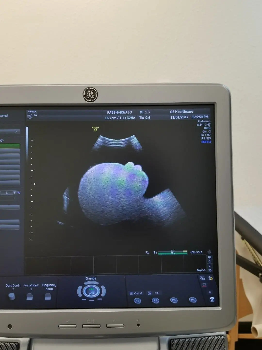 GE RAB2-6-RS Ultrasound Probe / Transducer demo DIAGNOSTIC ULTRASOUND MACHINES FOR SALE