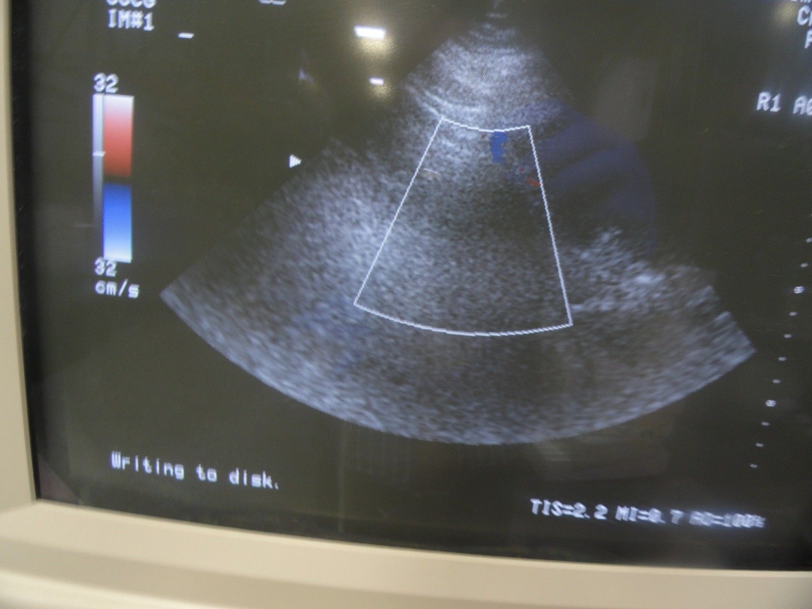 GE 227s P/N 2118743 Phased Array 2-4 MHz Probe W/ Hook for GE Logiq 700 (5979 DIAGNOSTIC ULTRASOUND MACHINES FOR SALE