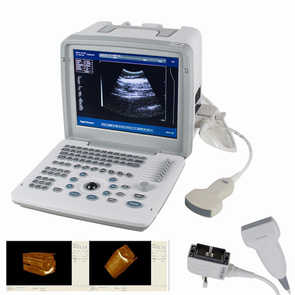 Pro Digital SVGA 3D Portable Ultrasound Scanner Machine Convex Linear 2 Probes 190891567949 DIAGNOSTIC ULTRASOUND MACHINES FOR SALE
