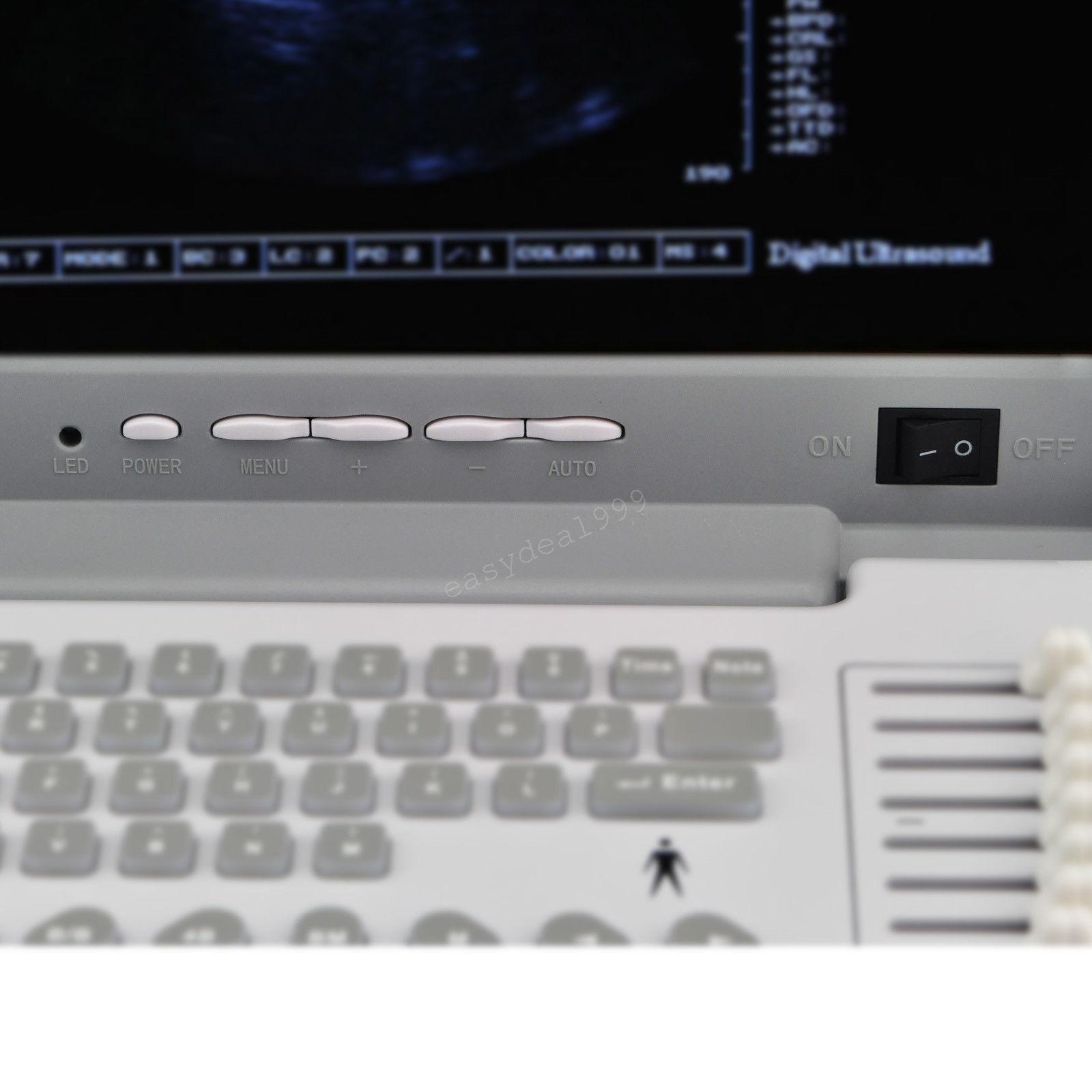 Digital Portable Ultrasound Scanner Machine Convex Linear Transvaginal 3 Probes* DIAGNOSTIC ULTRASOUND MACHINES FOR SALE