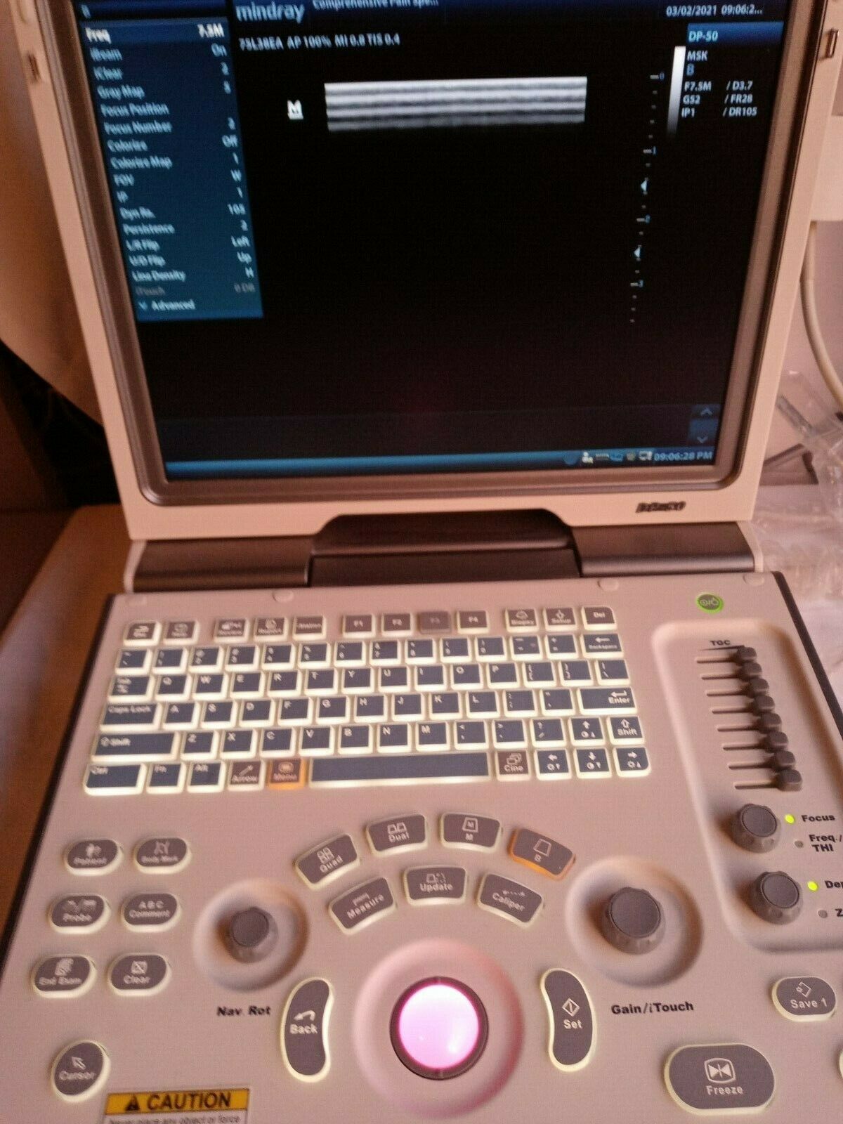 MINDRAY DIGITAL ULTRASOUND DIAGNOSTIC IMAGING SYSTEM,GREAT CONDITION(DP-50) DIAGNOSTIC ULTRASOUND MACHINES FOR SALE