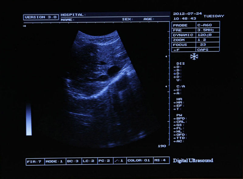 Pro Medical Ultrasound Scanner Scan Convex Linear Transvaginal Probes Pregnancy 190891506153 DIAGNOSTIC ULTRASOUND MACHINES FOR SALE