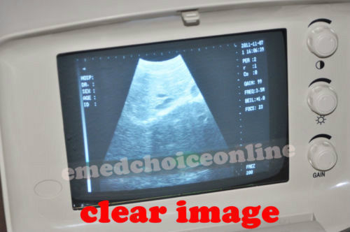 Portable Machine Digital Ultrasound Scanner Transvaginal Probe 3D Software Gift 190891982230 DIAGNOSTIC ULTRASOUND MACHINES FOR SALE
